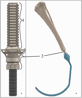 Biomechanical Test of a New Endoprosthesis for Cylindrical Medullary Canals in Dogs